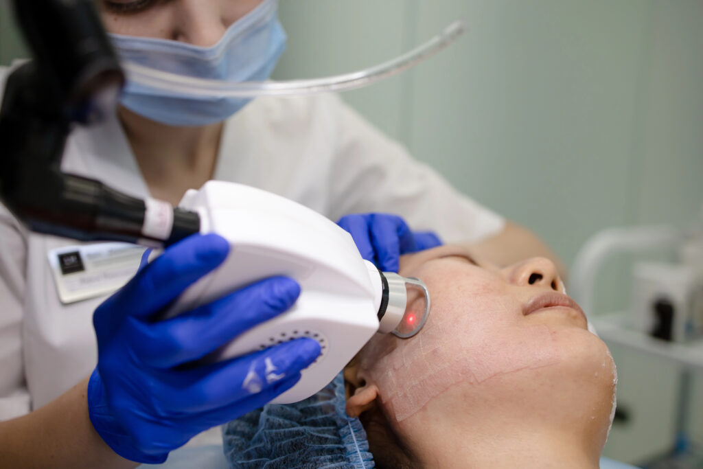 Laser Skin Treatment in Calgary